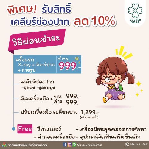 โปรนักเรียน(FB)-02